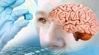 brain implant